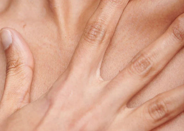How to Heal Eczema, Psoriasis and Rosacea Naturally